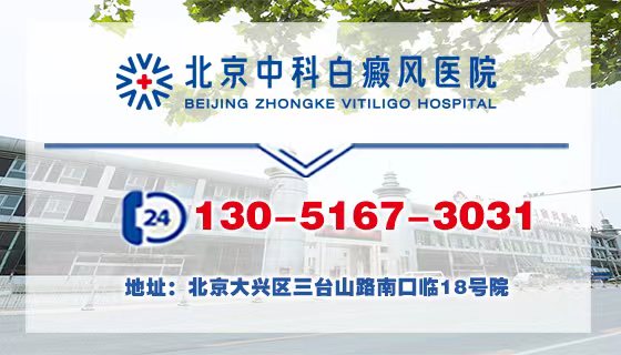 北京中科白癜风医院专病